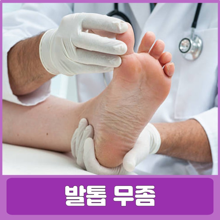 발톱무좀 치료 방법 및 증상 원인 : 네이버 블로그
