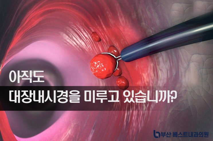 서면내과, 대장의 큰 용종 50대 건강검진 내시경 : 네이버 블로그