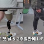 <인천의족>대퇴의족 착용 첫날 의족재활훈련 과정 : 케이엑스06(KX06)