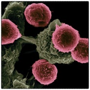 TP53유전자변이와 호르몬성 유방암의 예후