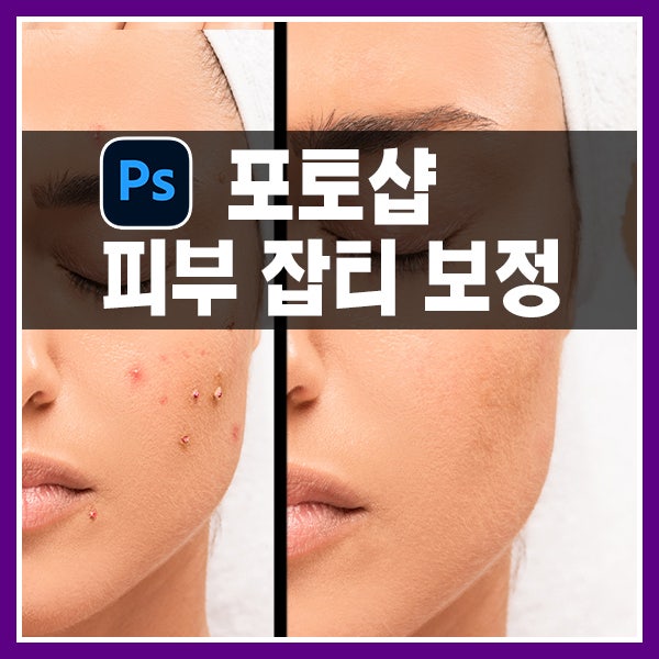 포토샵 피부 잡티 보정 제거하는 7가지 도구 사용방법과 비교 : 네이버 블로그