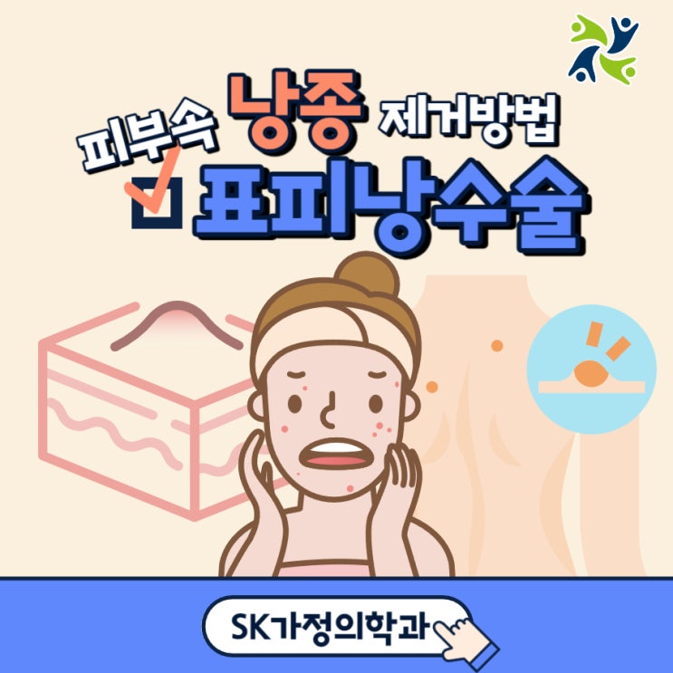 표피낭종 수술 SK가정의학과에서 흉터 없이 제거(동탄, 오산) : 네이버 블로그
