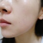 피부 일기 : 피부과미백관리와 브이라인리프팅 1타2피 솔직후기(BBL쥴레이저&레블라이트 조합 추천)