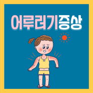 피부 등 어루러기 증상 원인 치료 전염 연고 알아보고 예방해요