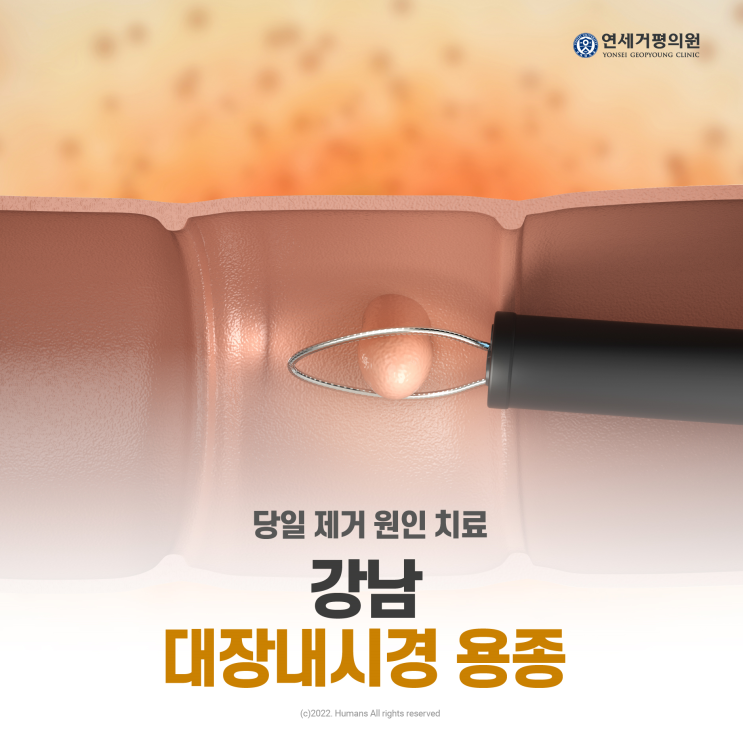 강남구 대장내시경 용종 당일 제거 원인 치료 : 네이버 블로그