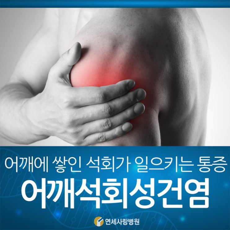 어깨석회성건염 치료, 어깨 급성 통증 원인 : 네이버 블로그