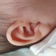 D+62 2개월예방접종,지루성피부염 귀