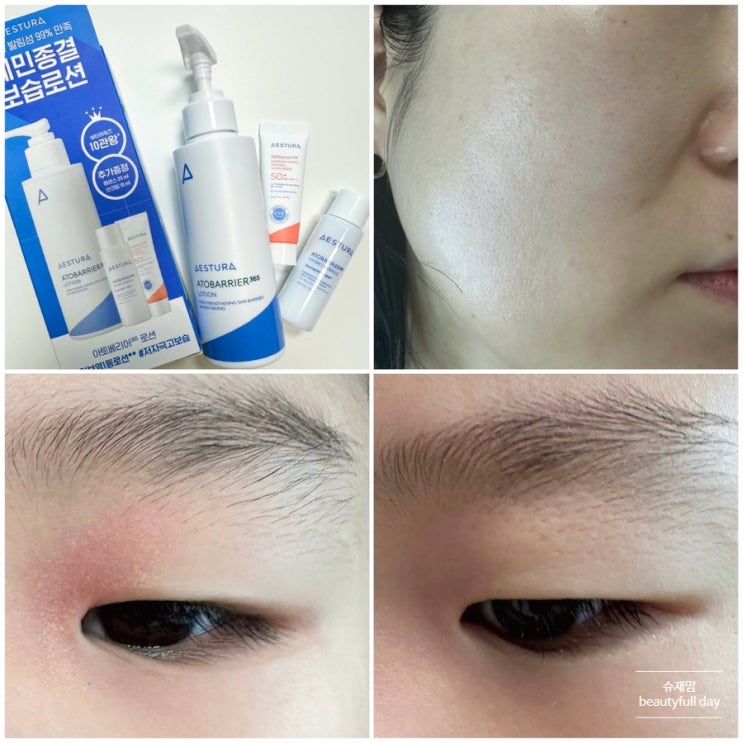 에스트라 아토베리어365 로션, 보습 꽉꽉 채워주는 산뜻 로션 내돈내산 사용후기 : 네이버 블로그