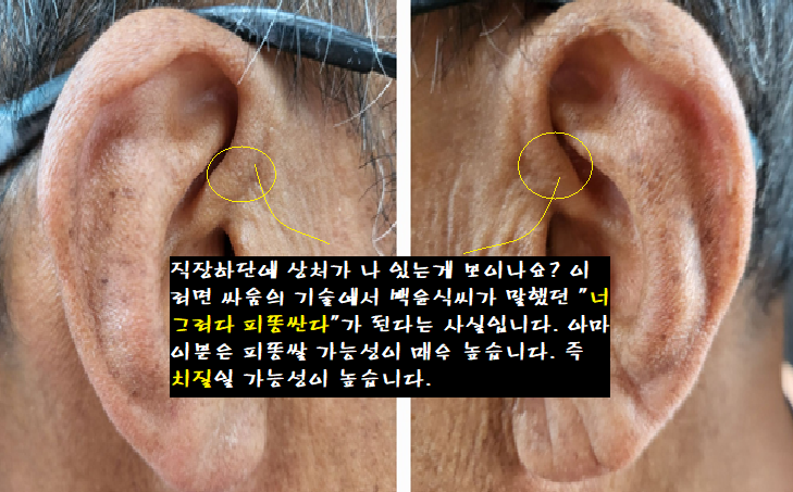 너 그러다 피똥싼다? ㅋ ㅋ : 네이버 블로그