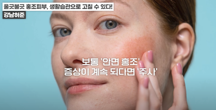 홍조 고민이라면 이렇게만 하세요! 홍조피부관리, 생활습관 : 네이버 블로그
