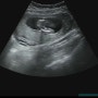 임신 15 - 17주차 : 소소한 변화들..