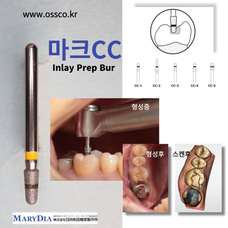 marked CC inlay prep bur, 레이저마킹 인레이 다이아몬드 버 : 네이버 블로그