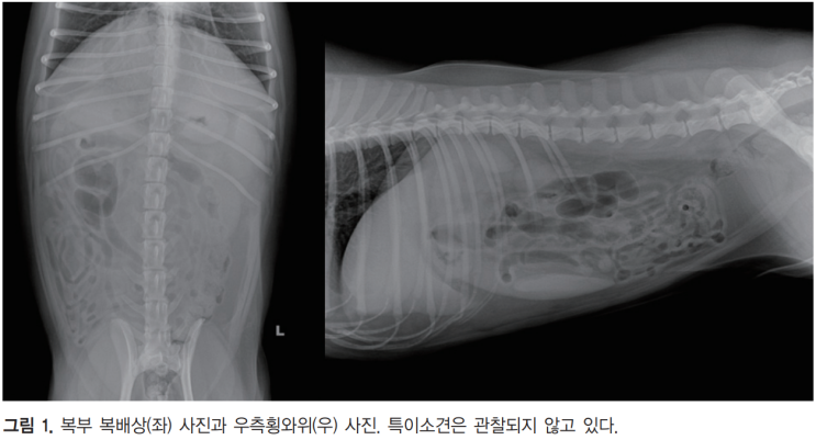 췌장염·장샘암으로 인한 간외성 담도 폐색, 담낭공장문합술(CCJ)로 성공 치료한 수술 증례 보고 : 네이버 블로그