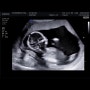 [임신 16주] 2차 기형아 검사, 성별 확인
