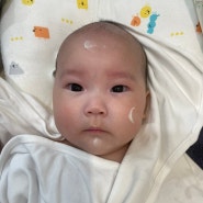 아기 피부 고보습크림 ㅣ 홍반 태열있는 아기한테 퓨토시크릿 아토밤 사용중 :)
