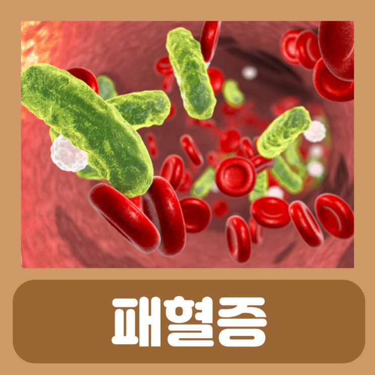 패혈증 이란 급성 패혈증, 비브리오 패혈증 증상 원인 폐혈증 : 네이버 블로그