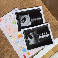 [임신 일기11] 쌍둥이임신 4주차~8주차 증상 / 쌍둥이 7주차 심장소리 :: 우리 두리 잘해보자 👨👩👧👦❤️
