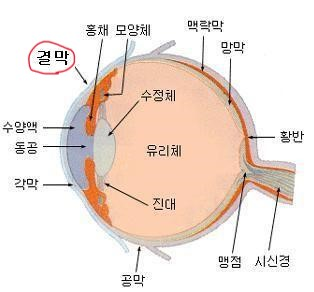 [Case] 눈 흰자에 생긴 점! (결막모반이란?) : 네이버 블로그