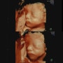 [임신일기8] 25~27주차 : 임신축하박스, 맘마존, 입체초음파