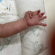 엄지 손가락을 접고 있는 아기 언제 필까? 방아쇠수지근? 소근육 발달