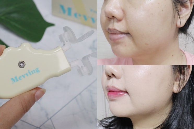 데일리원더미브잉 뮤잉운동으로 턱라인 관리하기 3주 후기 : 네이버 블로그