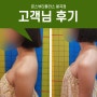 구미피부샵 일자목 거북목관리 추천 문스뷰티플러스 리뷰