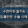 양주수면치과/의정부수면치과, 의정부 수면임플란트 :: 수면마취 당일 발치 및 임플란트 식립, 상악동거상술 진행 수술 사례