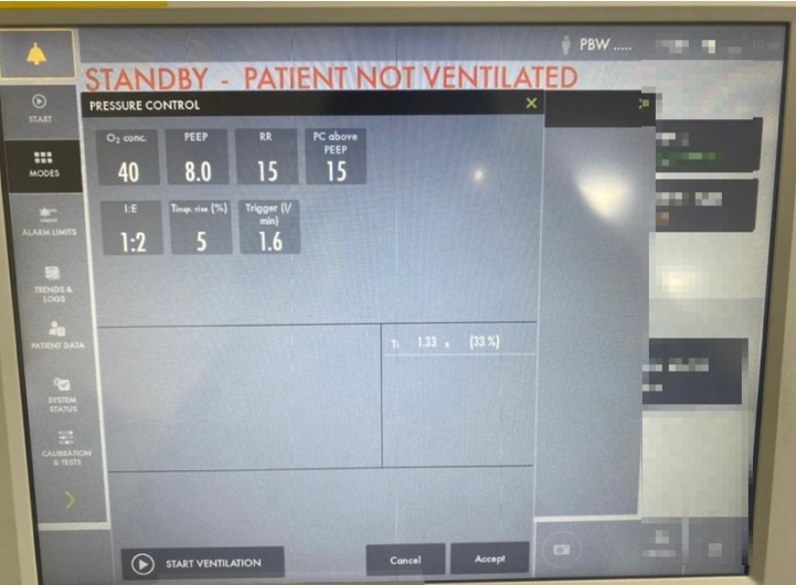 간호사가 알아야하는 벤틸레이터 모드 쉽게 외우는 방법!ventilator mode CMV, ACMV, PRVC, SIMV ...
