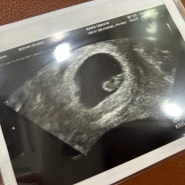 [임신 7주] 부천시 보건소 임산부 무료산전검사 받기