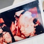 [임신 26-28주차]4D입체초음파, 백일해 접종, 이케아로스코그, 노시부, 만삭사진