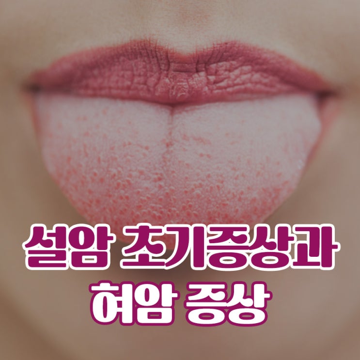 설암 초기증상, 혀암 증상 총 정리 : 네이버 블로그