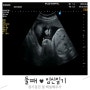 [둘째임신] 31주 정기검진 / 백일해주사 + 백의고혈압