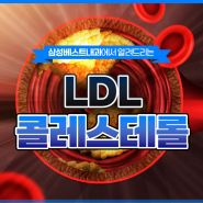 LDL 콜레스테롤 수치 높게 나왔다면