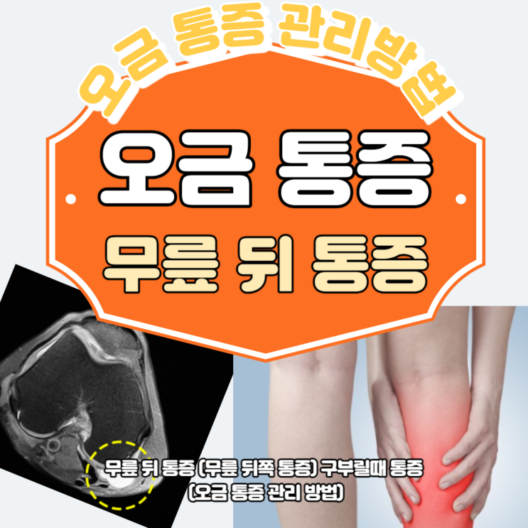 무릎 뒤 통증 (무릎뒤쪽통증) 구부릴때 통증 (오금 통증 관리 방법) : 네이버 블로그