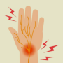 손목터널증후군, 발목터널증후군의 원인, 증상, 예방치료