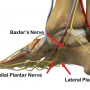 baxter nerve entrapment - 발뒤꿈치 통증, 뒤꿈치가 아파요,박스터 신경포착 / 한방치료