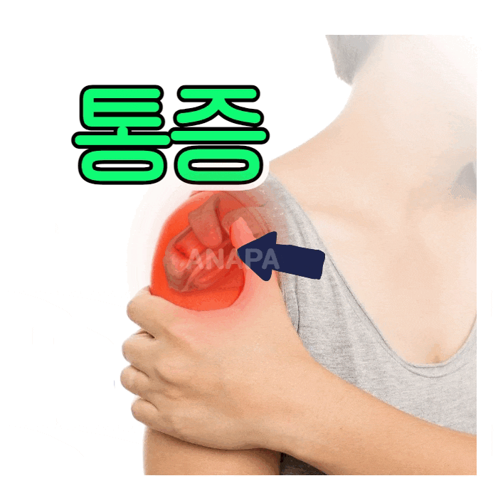 어깨인대파열 증상 및 힘줄 염증 생겼을때 : 네이버 블로그