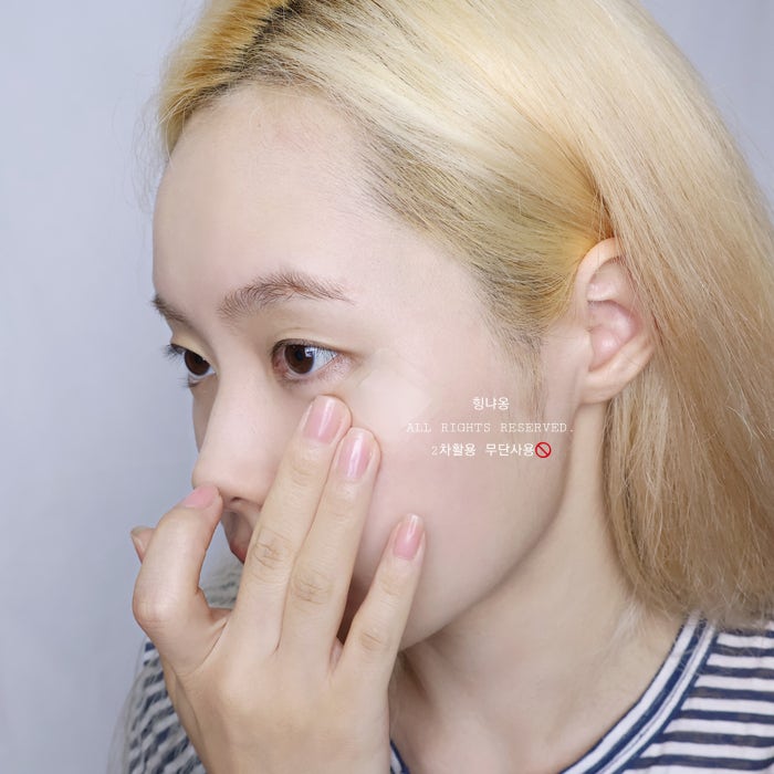 미간 주름 방지 메디테라피 슈마지 니들패치 : 네이버 블로그