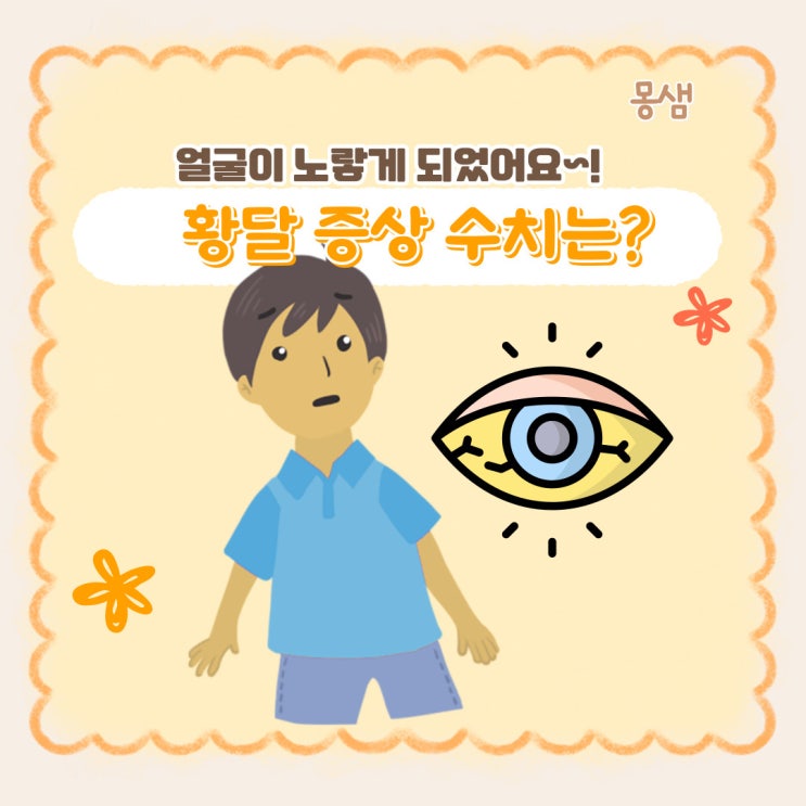 성인 황달 수치 얼굴 증상 종류별 원인 치료는? : 네이버 블로그