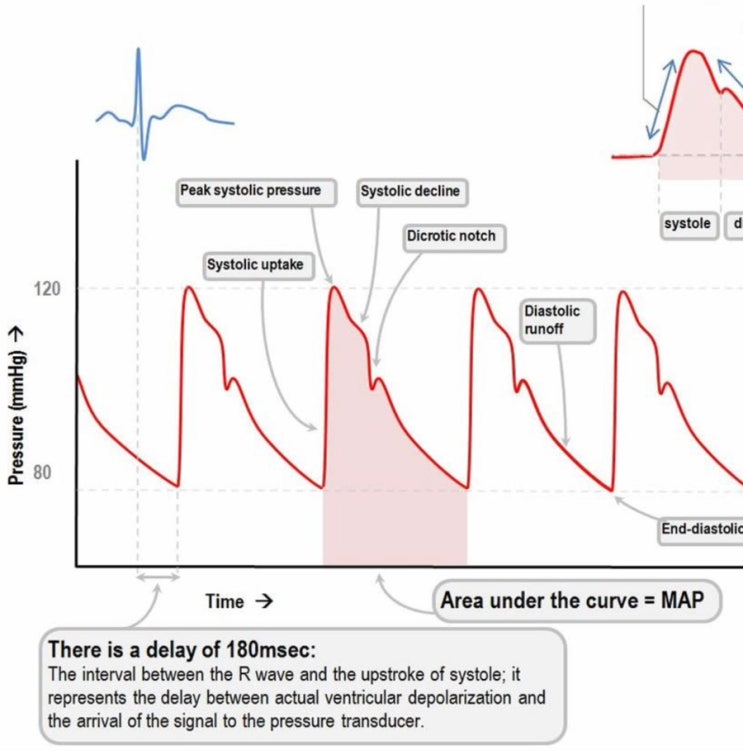 평균동맥압 (MAP) Arterial line ABP 공부하기 : 네이버 블로그