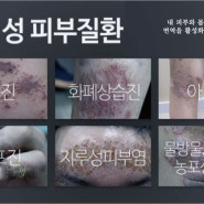 피부질환 한의원 창원 코아한의원