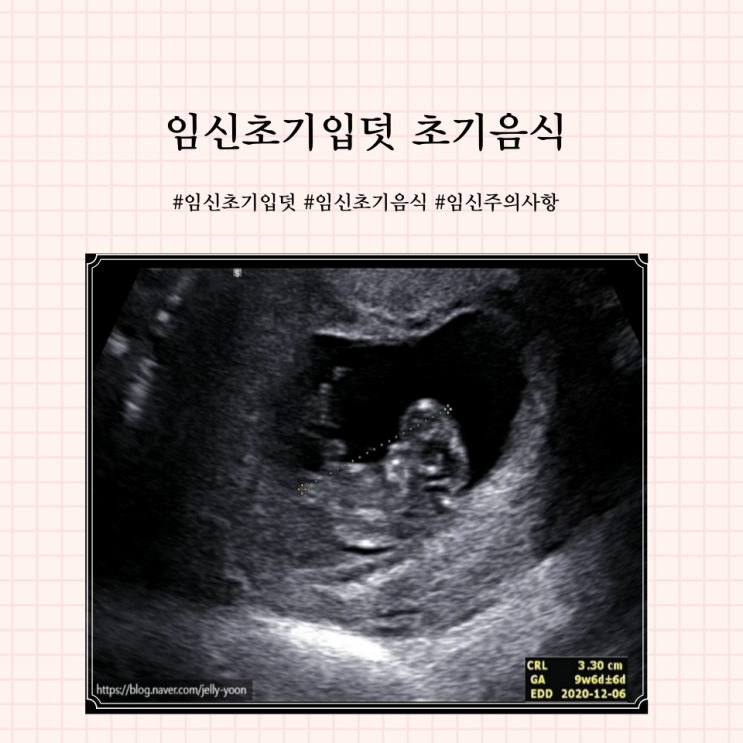 입덧초기 좋은 음식 입덧 시작 시기 주의사항 조심해야할것 : 네이버 블로그