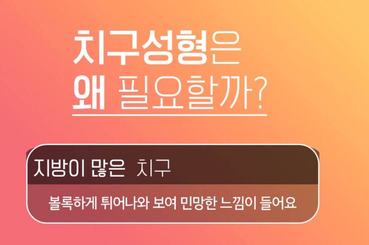 치구성형 이미 유로진이 잘한다는 거 아실걸요? : 네이버 블로그