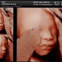 [임신 27주] 미래제일산부인과 입체초음파 두번찍은 후기