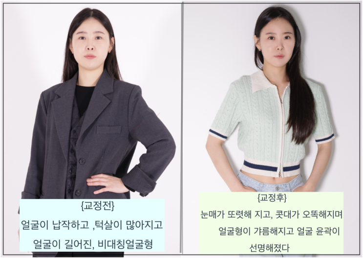 얼굴붓기빼기는 체형교정운동으로,얼굴살 빼기 성공/바른체 박숙희 : 네이버 블로그