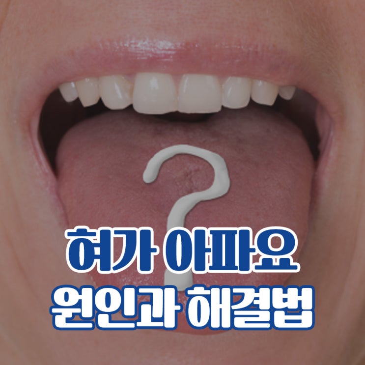 설암 초기증상 이것이 발견된다면 : 네이버 블로그
