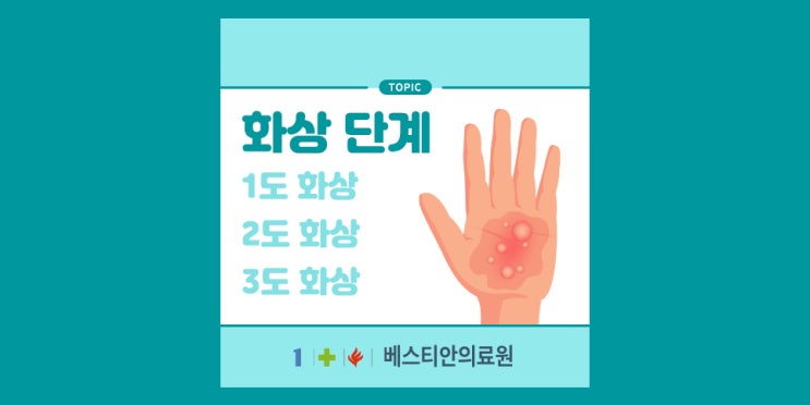 화상 단계, 화상입었을 때 1도, 2도, 3도 화상 단계 및 치료방법 : 네이버 블로그