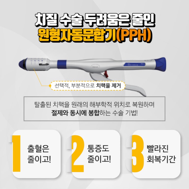 삼송 치질수술, 전문의 PPH 원형자동문합기 수술! : 네이버 블로그