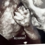 임신일기) 임신 36주 차 증상, 그간 기록들 (니프티 검사, 임당 검사, 입체 초음파 등등)