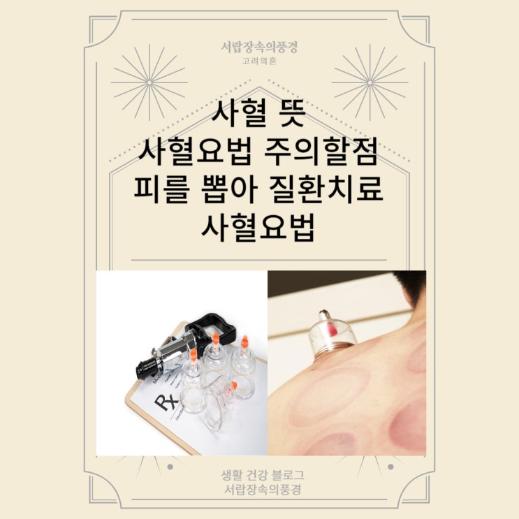 사혈 사혈 효과 사혈 뜻 사혈요법 주의할점 피를 뽑아 질환 치료 사혈요법 : 네이버 블로그